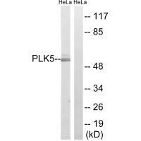 PLK5 Antibody in Western Blot (WB)