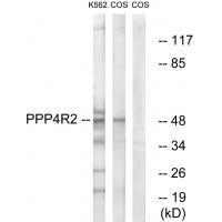 PPP4R2 Antibody in Western Blot (WB)
