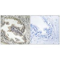SH3GLB2 Antibody in Immunohistochemistry (Paraffin) (IHC (P))