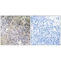 SHC3 Antibody in Immunohistochemistry (Paraffin) (IHC (P))