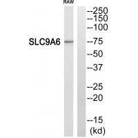 SLC9A6 Antibody in Western Blot (WB)