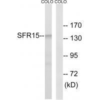 SFRS15 Antibody in Western Blot (WB)