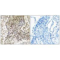 TSEN54 Antibody in Immunohistochemistry (Paraffin) (IHC (P))
