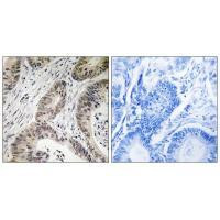 TUT1 Antibody in Immunohistochemistry (Paraffin) (IHC (P))
