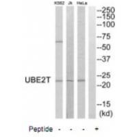 UBE2T Antibody in Western Blot (WB)
