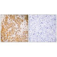 ZNF50 Antibody in Immunohistochemistry (Paraffin) (IHC (P))
