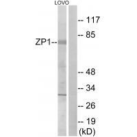 ZP1 Antibody in Western Blot (WB)