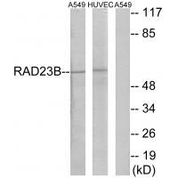 RAD23B Antibody in Western Blot (WB)