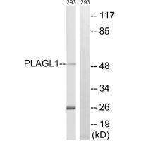 PLAGL1 Antibody in Western Blot (WB)