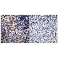 MCPH1 Antibody in Immunohistochemistry (Paraffin) (IHC (P))