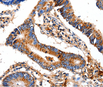 COX8A Antibody in Immunohistochemistry (Paraffin) (IHC (P))