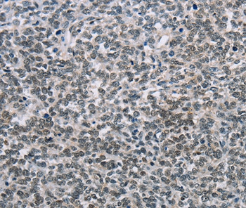 NFKBIL2 Antibody in Immunohistochemistry (Paraffin) (IHC (P))