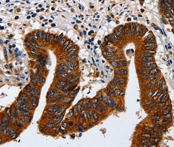 Cytokeratin 23 Antibody in Immunohistochemistry (Paraffin) (IHC (P))