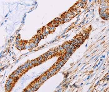 ATP5J Antibody in Immunohistochemistry (Paraffin) (IHC (P))