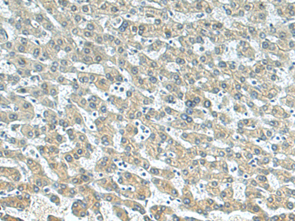 BTG3 Antibody in Immunohistochemistry (Paraffin) (IHC (P))