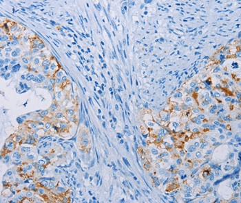 Carbonic Anhydrase X Antibody in Immunohistochemistry (Paraffin) (IHC (P))