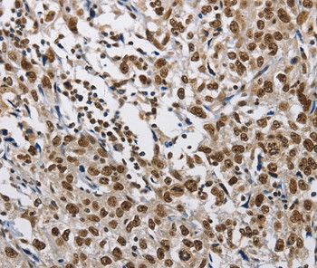 CMTM2 Antibody in Immunohistochemistry (Paraffin) (IHC (P))