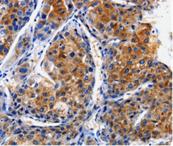 CLCA4 Antibody in Immunohistochemistry (Paraffin) (IHC (P))