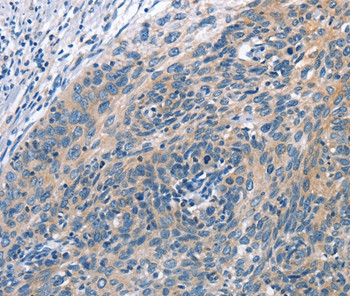 Cullin 7 Antibody in Immunohistochemistry (Paraffin) (IHC (P))