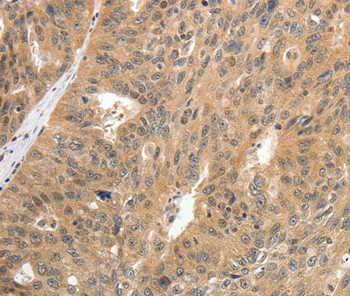 CNNM3 Antibody in Immunohistochemistry (Paraffin) (IHC (P))