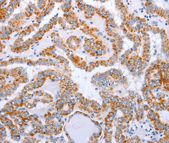 DTX2 Antibody in Immunohistochemistry (Paraffin) (IHC (P))