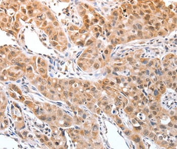 DPPA2 Antibody in Immunohistochemistry (Paraffin) (IHC (P))