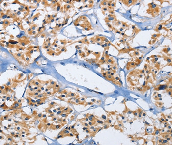 DUSP19 Antibody in Immunohistochemistry (Paraffin) (IHC (P))