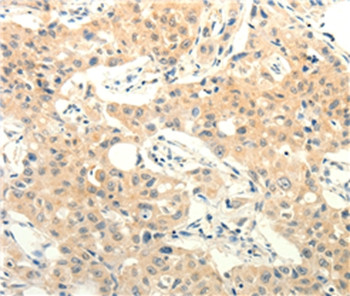 FOXR2 Antibody in Immunohistochemistry (Paraffin) (IHC (P))