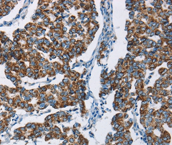 HINT2 Antibody in Immunohistochemistry (Paraffin) (IHC (P))