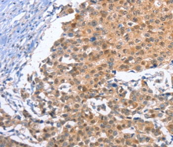 KLF15 Antibody in Immunohistochemistry (Paraffin) (IHC (P))