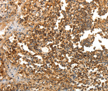LRP12 Antibody in Immunohistochemistry (Paraffin) (IHC (P))