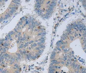 MAGEB4 Antibody in Immunohistochemistry (Paraffin) (IHC (P))