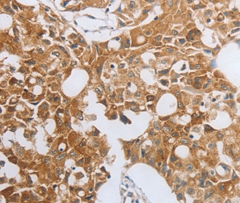 MUC20 Antibody in Immunohistochemistry (Paraffin) (IHC (P))