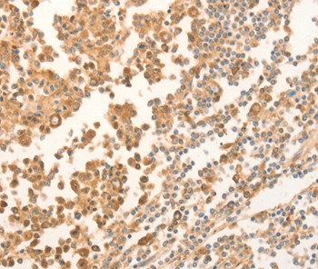 NAP1L1 Antibody in Immunohistochemistry (Paraffin) (IHC (P))