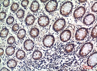 OAS2 Antibody in Immunohistochemistry (Paraffin) (IHC (P))