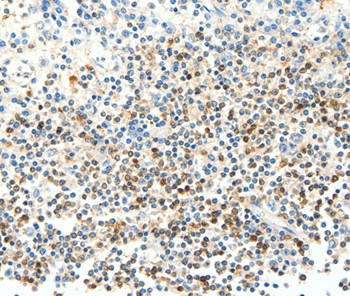 FAM3A Antibody in Immunohistochemistry (Paraffin) (IHC (P))