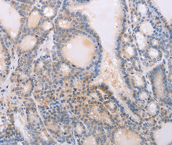 Profilin 4 Antibody in Immunohistochemistry (Paraffin) (IHC (P))