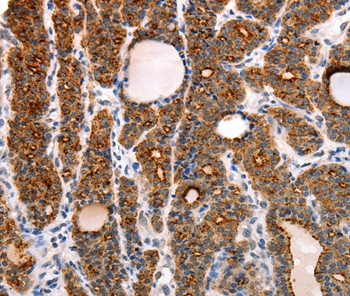 RAMP1 Antibody in Immunohistochemistry (Paraffin) (IHC (P))