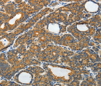 RAMP3 Antibody in Immunohistochemistry (Paraffin) (IHC (P))