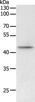 PHF6 Antibody in Western Blot (WB)