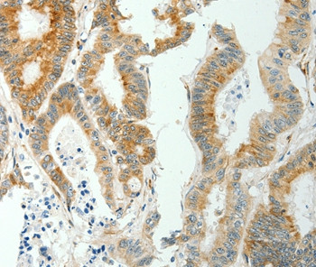 SELM Antibody in Immunohistochemistry (Paraffin) (IHC (P))