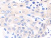SOCS6 Antibody in Immunohistochemistry (Paraffin) (IHC (P))