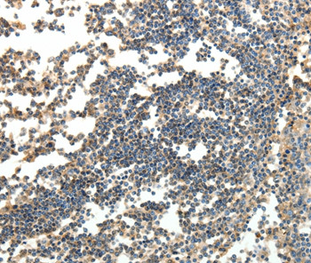 SPAG8 Antibody in Immunohistochemistry (Paraffin) (IHC (P))