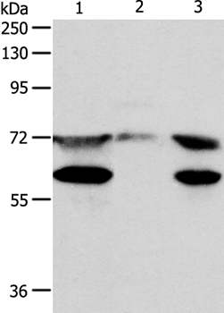 SPDL1 Antibody in Western Blot (WB)