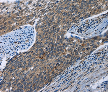 Synaptotagmin 3 Antibody in Immunohistochemistry (Paraffin) (IHC (P))