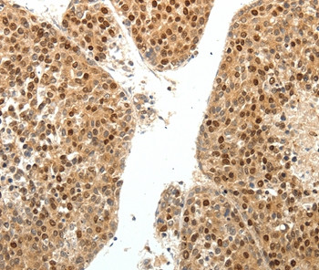 SPATA2L Antibody in Immunohistochemistry (Paraffin) (IHC (P))