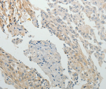 SPATA17 Antibody in Immunohistochemistry (Paraffin) (IHC (P))