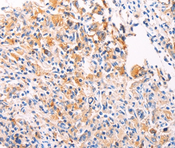 PGBD1 Antibody in Immunohistochemistry (Paraffin) (IHC (P))
