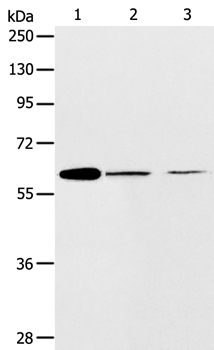 ABCE1 Antibody in Western Blot (WB)