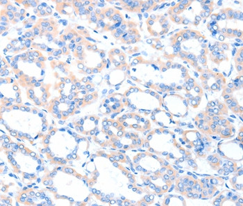 ACSM5 Antibody in Immunohistochemistry (Paraffin) (IHC (P))